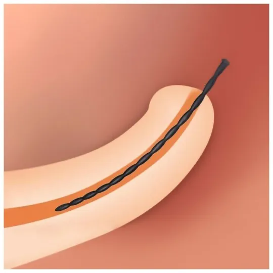 Уретральный стимулятор 744-09 BX DD